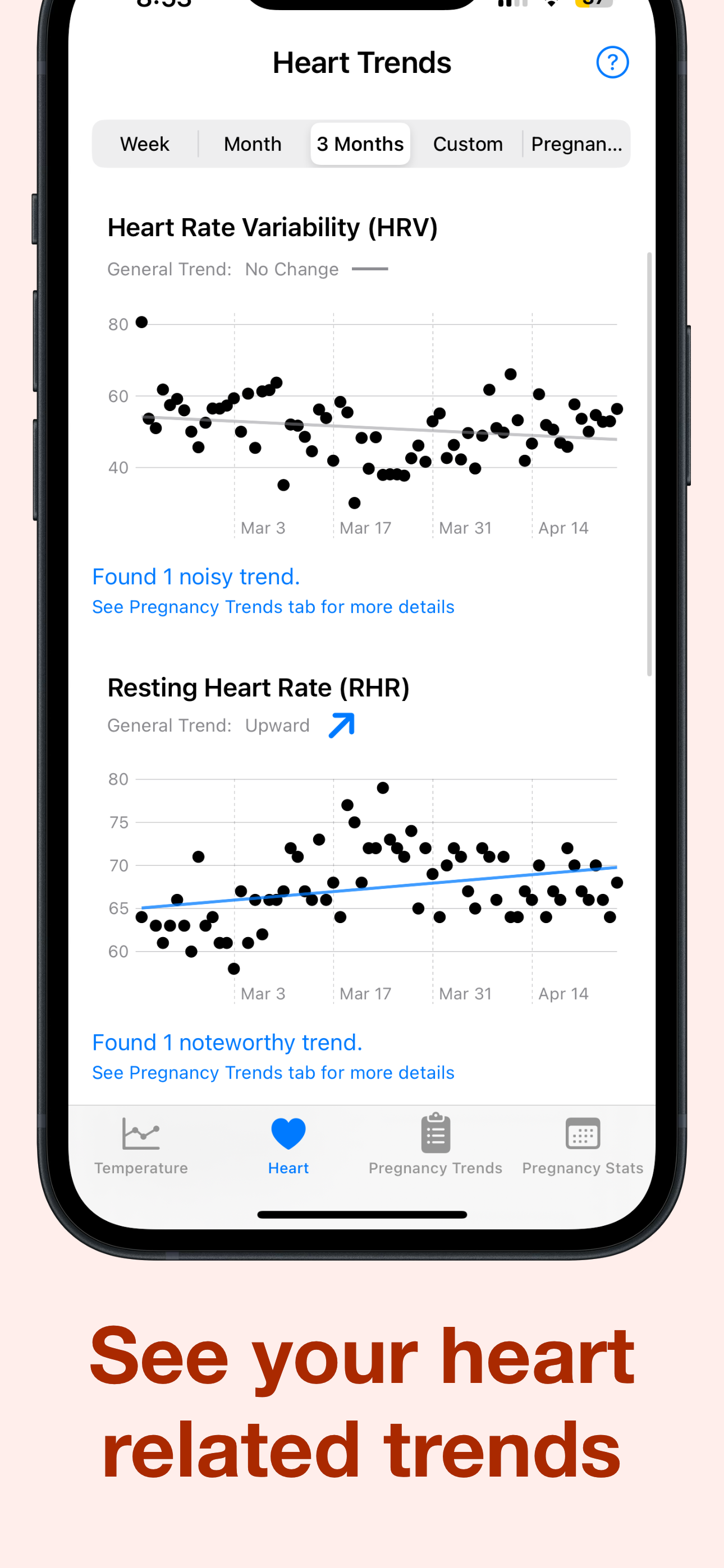 Example of a heart rate trend