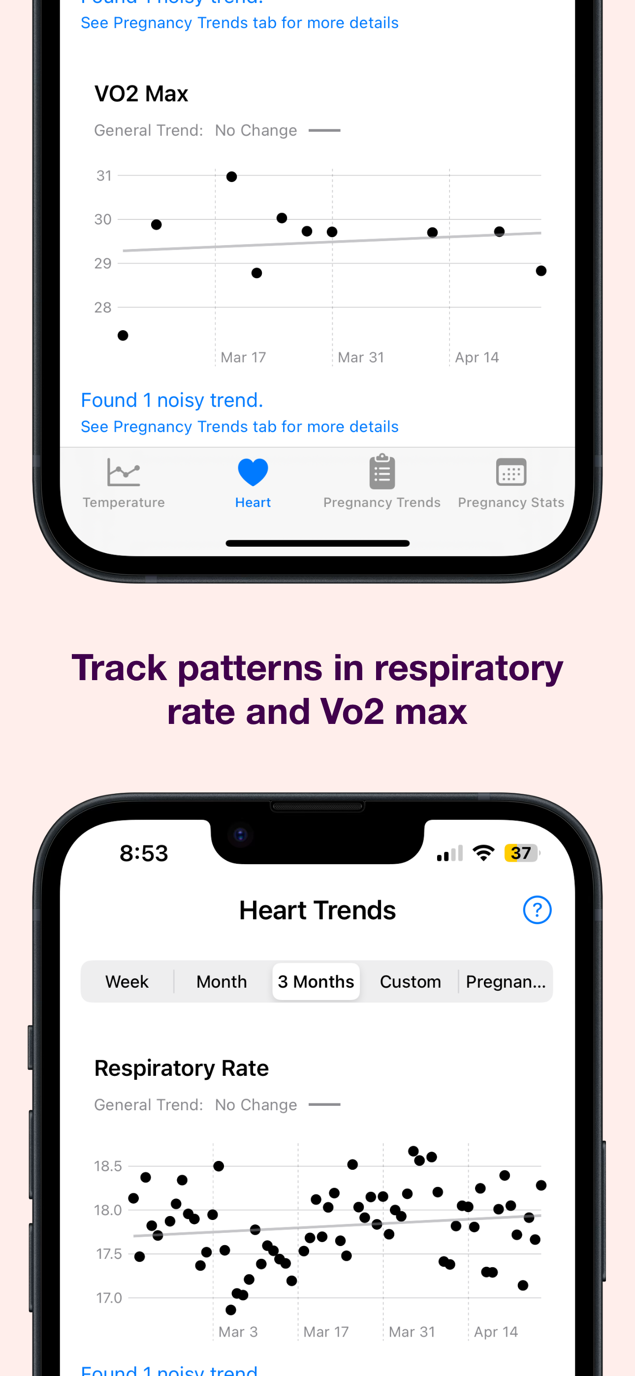 Example of a respiratory rate trend